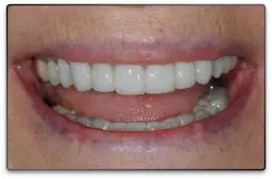 Kelowna Dentist