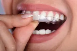 dentist-in-kelowna-WEB