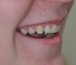 DSC_0849-e1545191021205