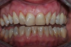 Kelowna Dentist