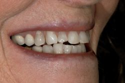 Kelowna Dentist