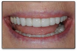 Kelowna Dentist
